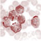 Workpackage 6: Acute Lymphoblastic Leukemia (ALL)
